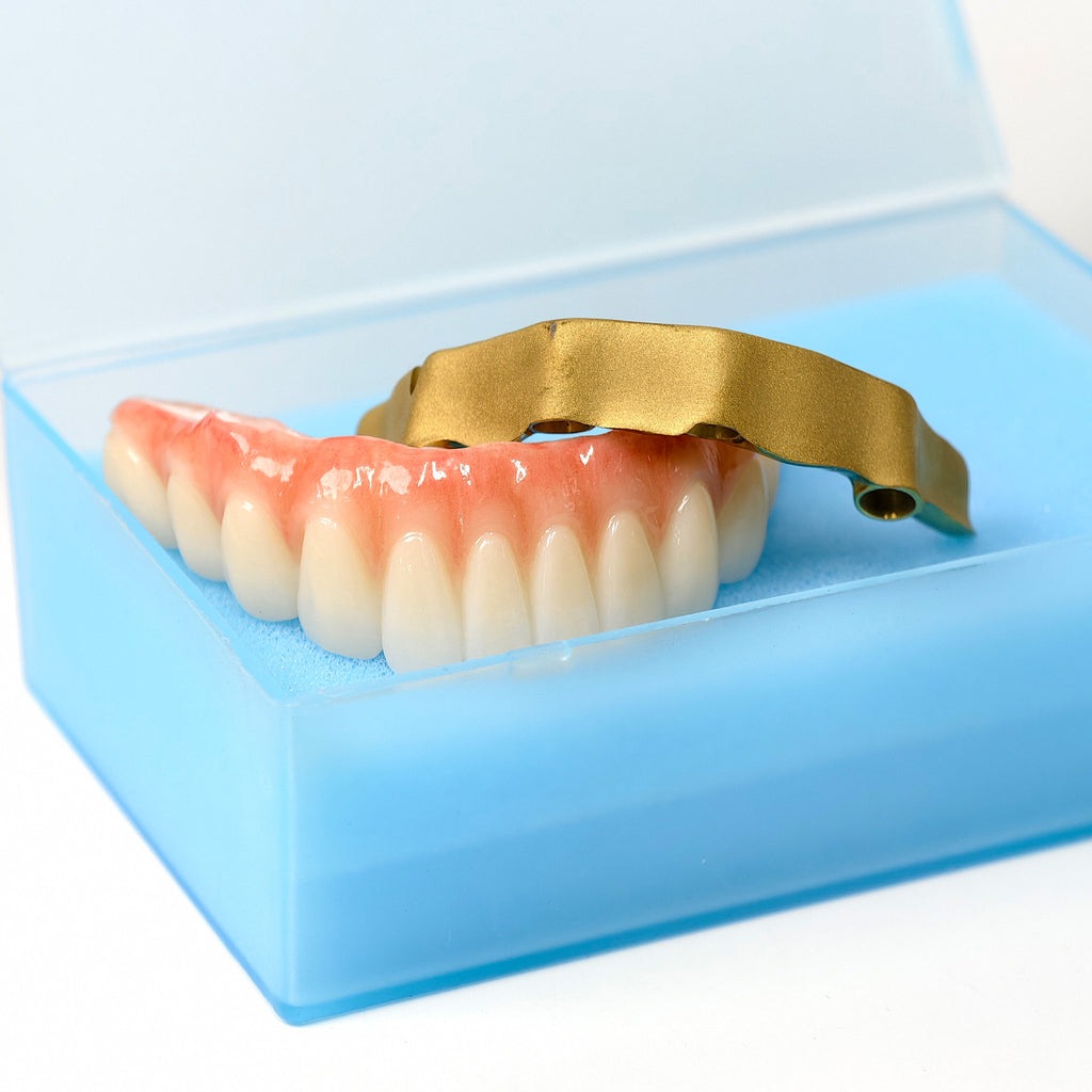 Ti-Bar Titanium Nitride Metal Frame With Zirconia Bridge For Full Arch Restoration