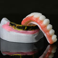 Ti-Bar Titanium Nitride Metal Frame With Zirconia Bridge For Full Arch Restoration