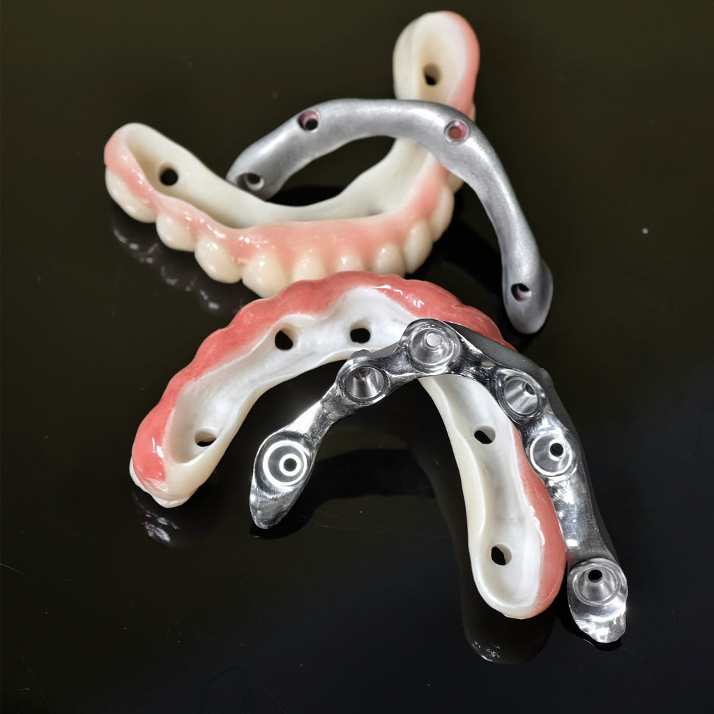 Ti-Bar Titanium Nitride Metal Frame With Zirconia Bridge For Full Arch Restoration