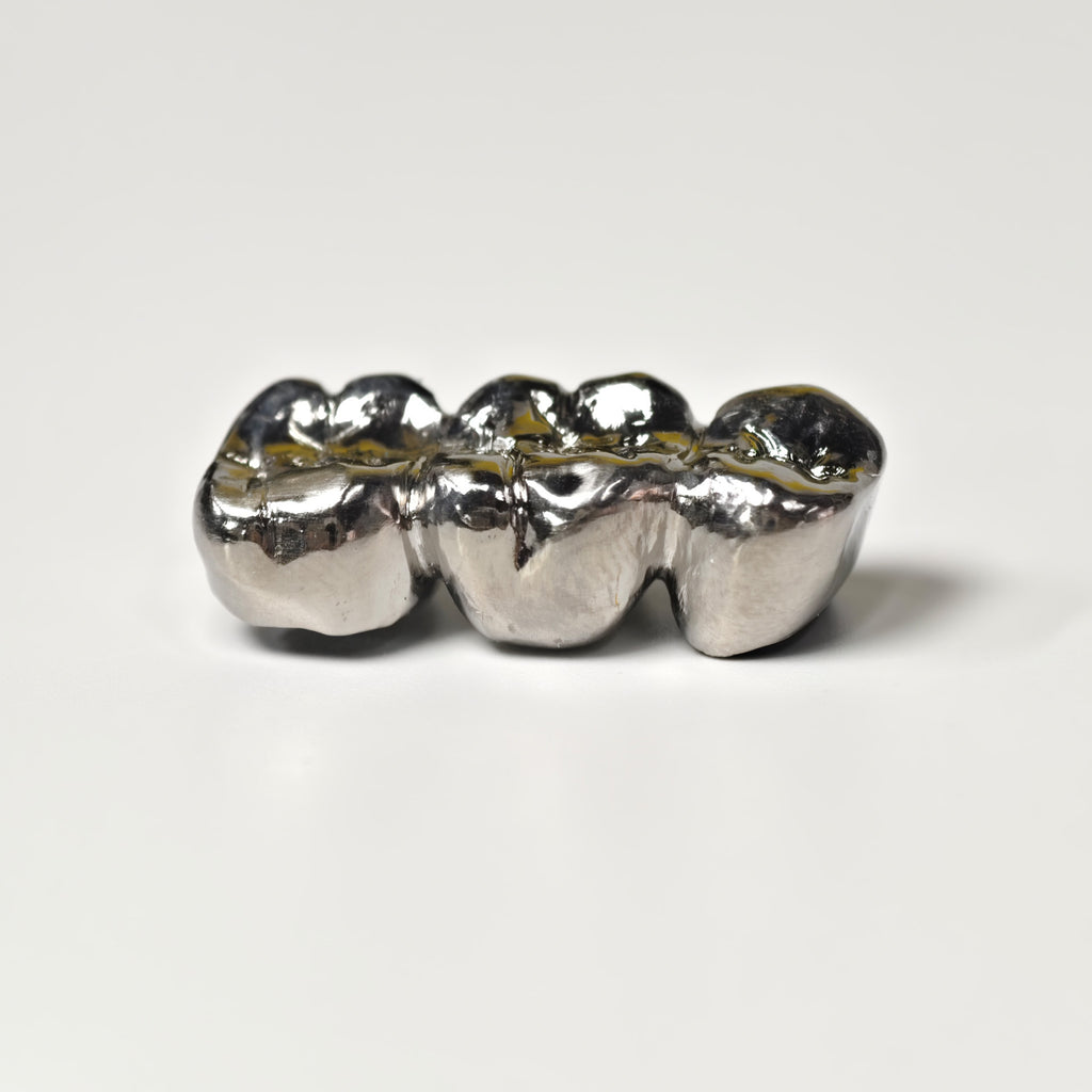 Titanium Crown With Cement Retained