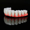 Traditional Malo Bridge With Alloy Framework Covering The Gingiva