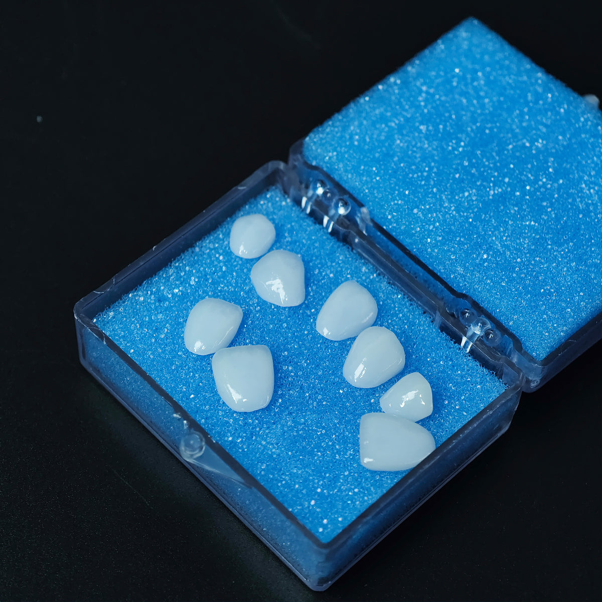 Ultra-Thin Emax Veneer. High Transparency/Translucent, Natural Shade