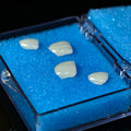 Ultra-Thin Emax Veneer. High Transparency/Translucent, Natural Shade