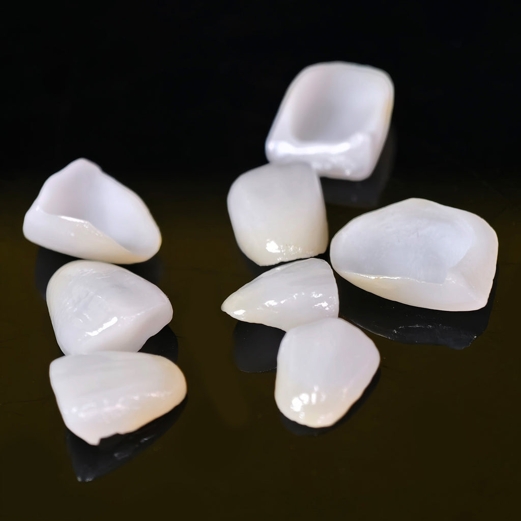 Ultra-Thin Emax Veneer. High Transparency/Translucent, Natural Shade