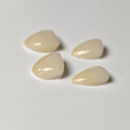 Ultra-Thin Emax Veneer. High Transparency/Translucent, Natural Shade