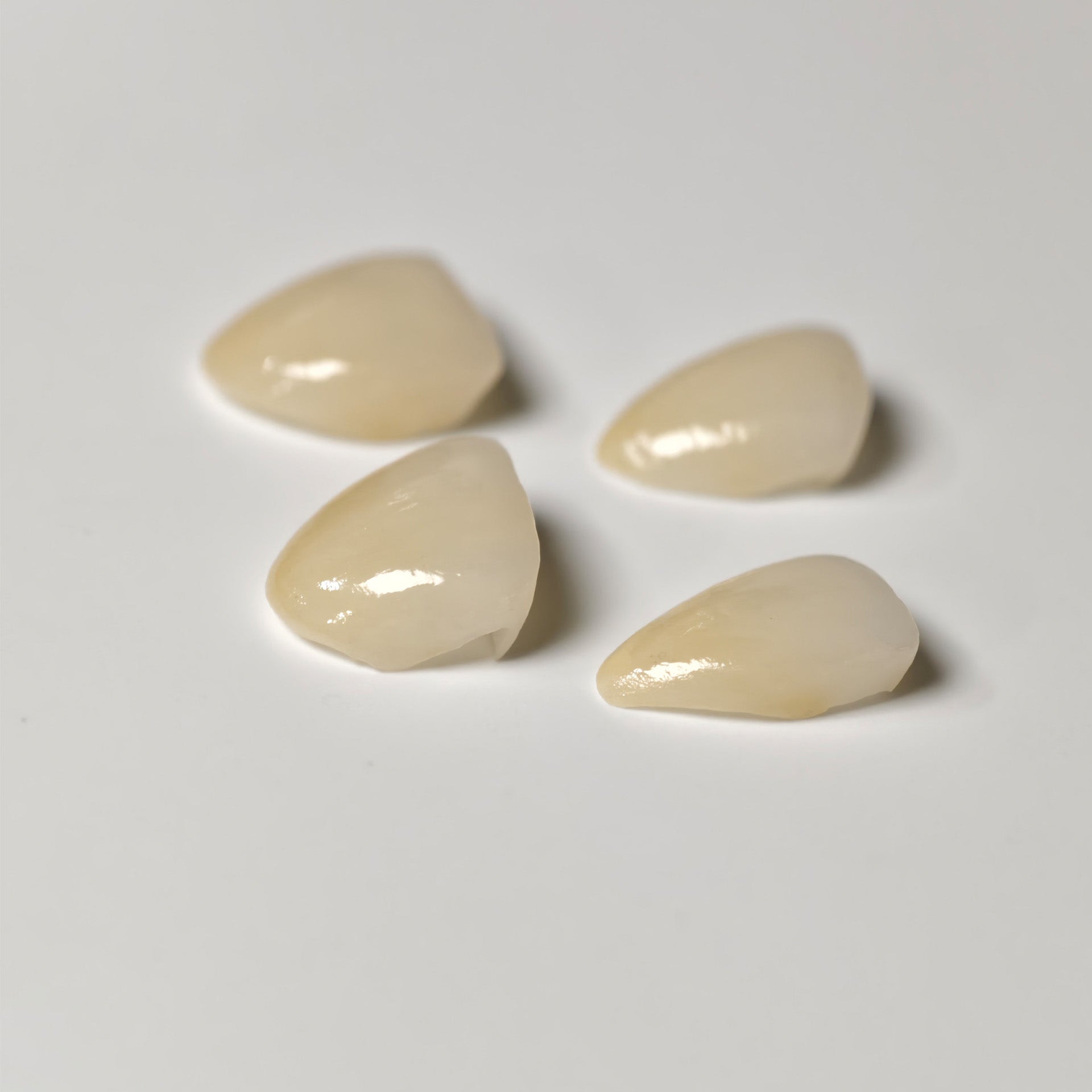 Ultra-Thin Emax Veneer. High Transparency/Translucent, Natural Shade