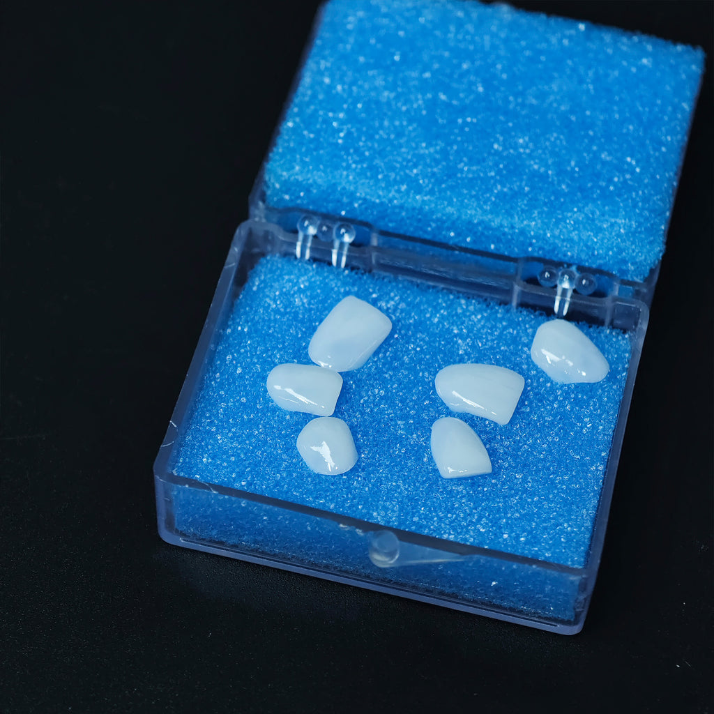 Ultra-Thin Emax Veneer. High Transparency/Translucent, Natural Shade