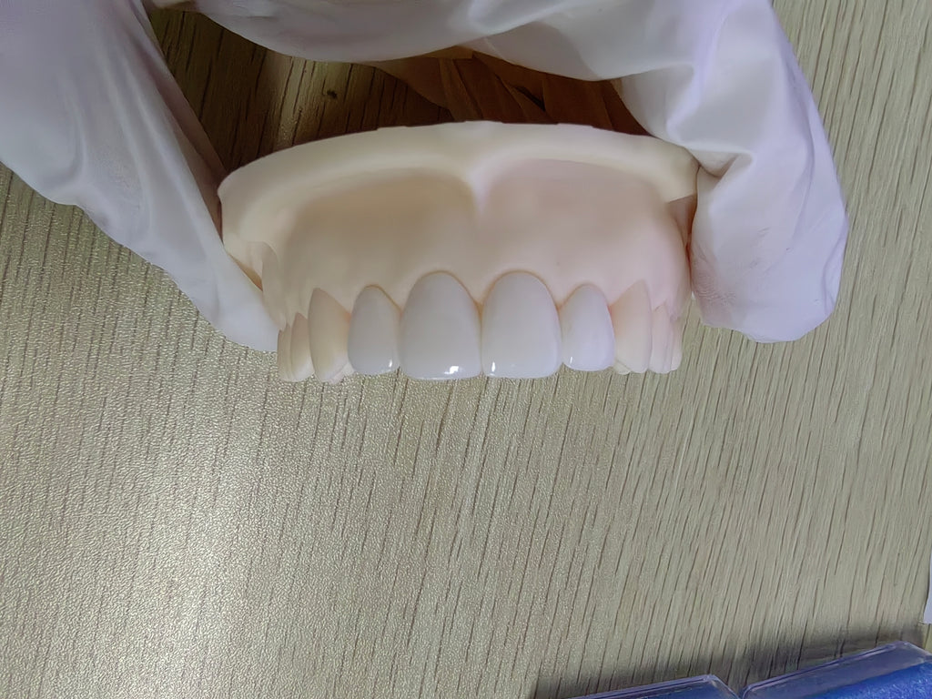 Ultra-Thin Emax Veneer. High Transparency/Translucent, Natural Shade