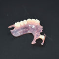 Valplast Denture Beautiful And Elastic Flexible Partial Natural Appearance