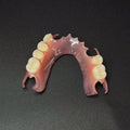 Valplast Denture Beautiful And Elastic Flexible Partial Natural Appearance