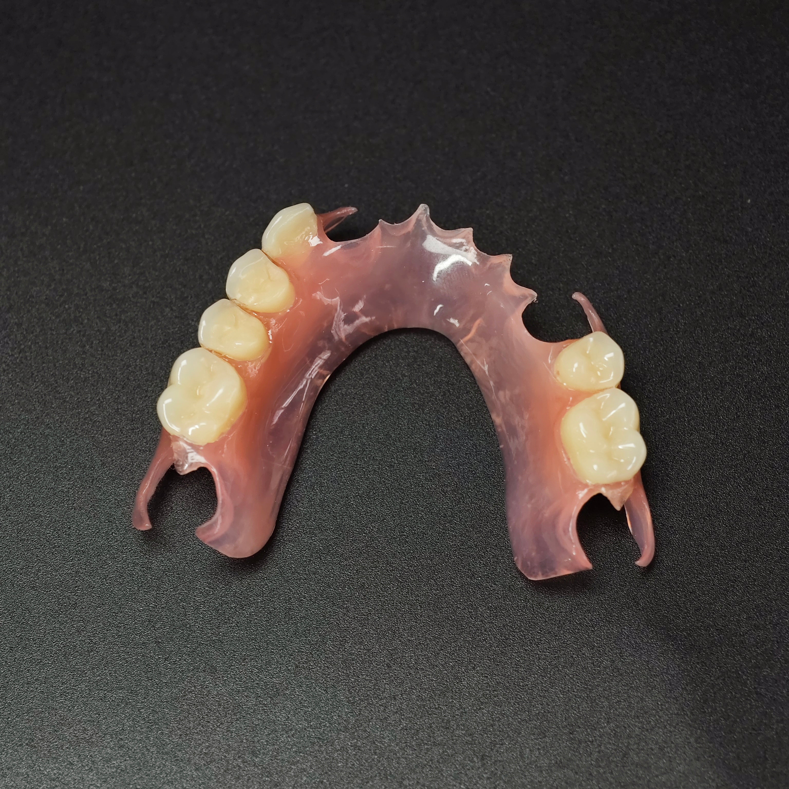 Valplast Denture Beautiful And Elastic Flexible Partial Natural Appearance