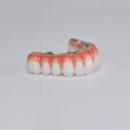 Zirconia-Enamel Hybrid Malo Bridge Aesthetic