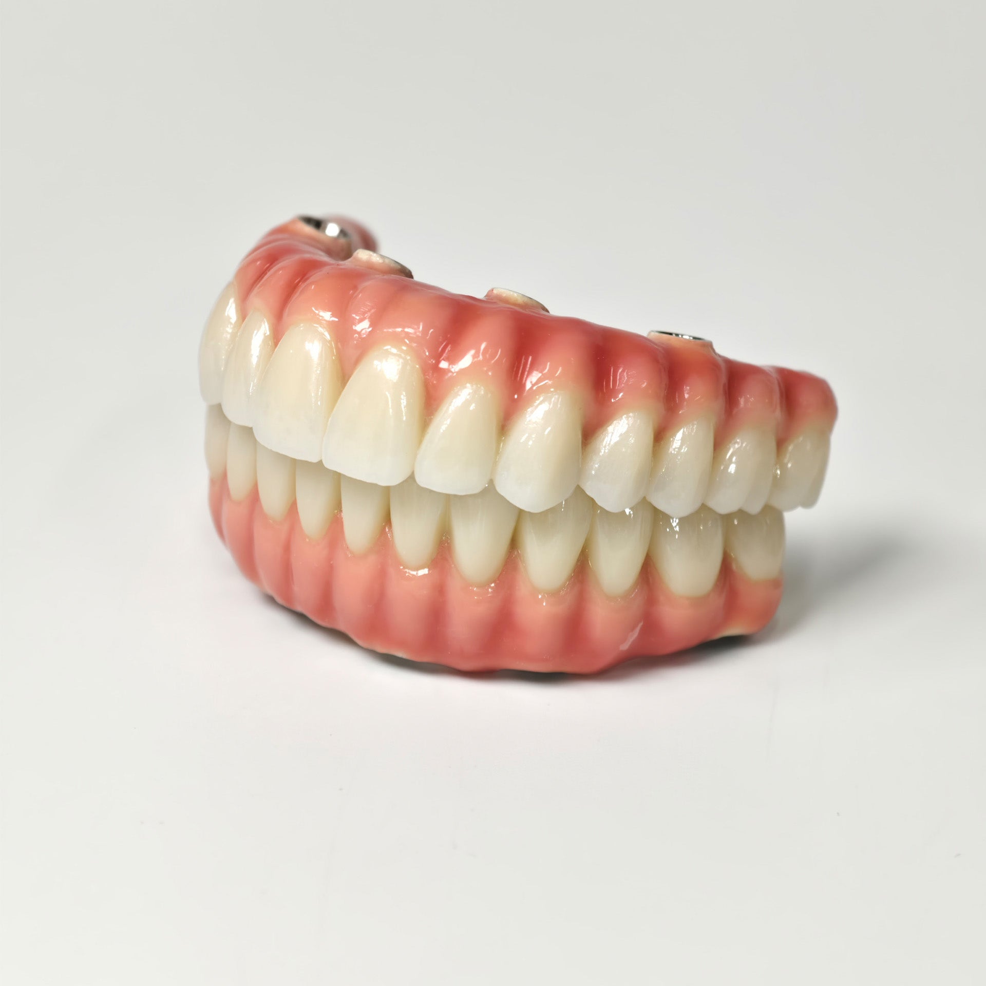 Zirconia-Enamel Hybrid Malo Bridge