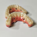 Zirconia-Enamel Hybrid Malo Bridge