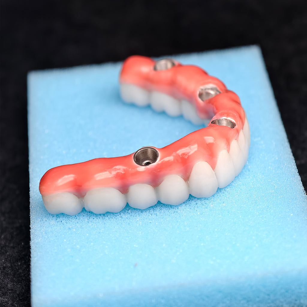 Zirconia-Enamel Hybrid Malo Bridge