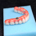 Zirconia-Enamel Hybrid Malo Bridge