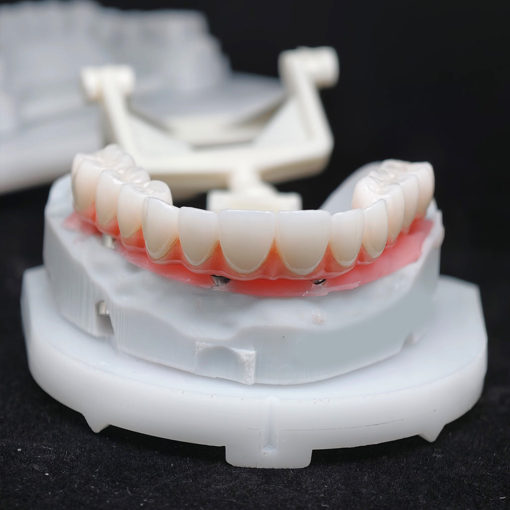 Zirconia-Enamel Hybrid Malo Bridge