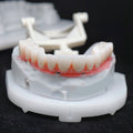 Zirconia-Enamel Hybrid Malo Bridge