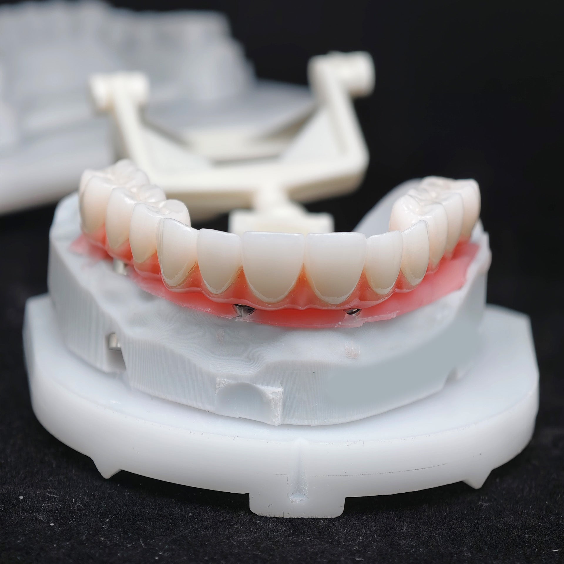 Zirconia-Enamel Hybrid Malo Bridge