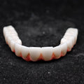 Zirconia-Enamel Hybrid Malo Bridge