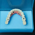 Zirconia-Enamel Hybrid Malo Bridge