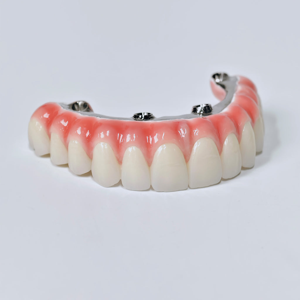 Zirconia-Enamel Hybrid Malo Bridge