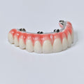 Zirconia-Enamel Hybrid Malo Bridge