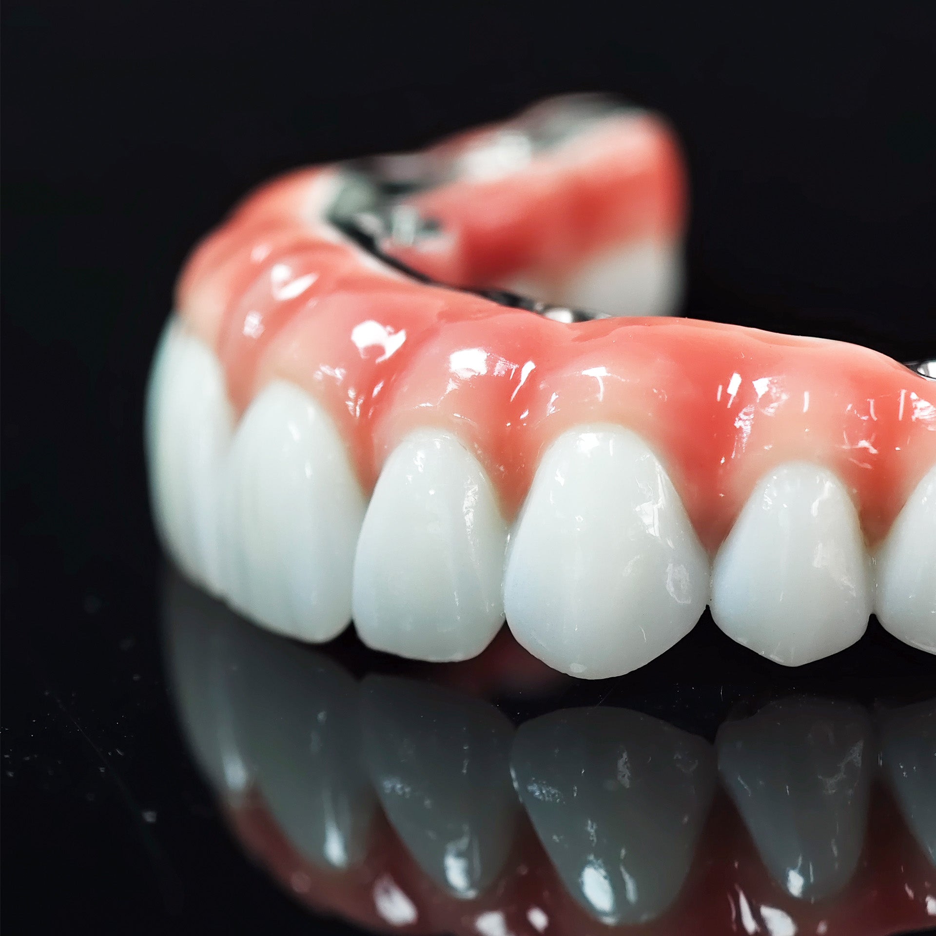 Zirconia-Enamel Hybrid Malo Bridge