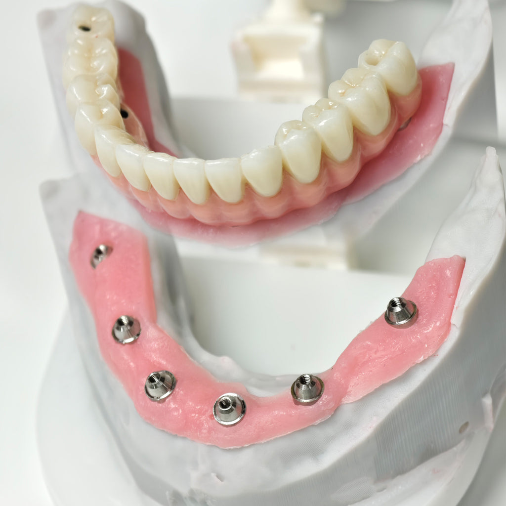 Zirconia-Enamel Hybrid Malo Bridge