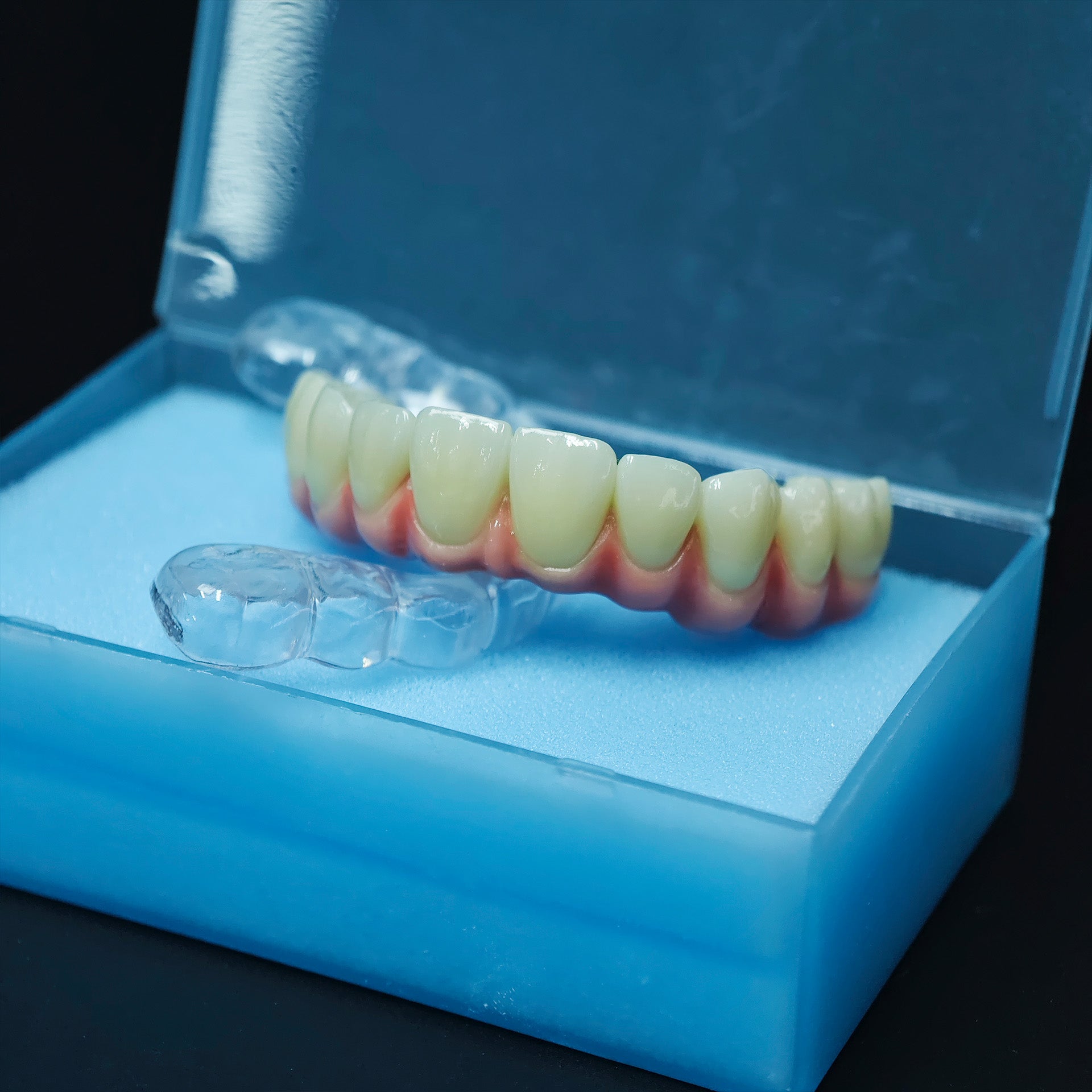 Zirconia-Enamel Hybrid Malo Bridge