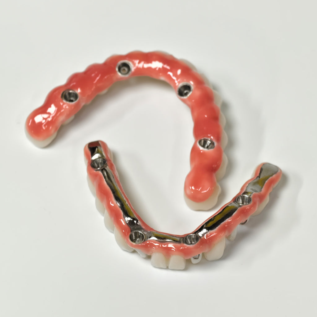 Zirconia-Enamel Hybrid Malo Bridge