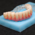 Zirconia-Enamel Hybrid Malo Bridge