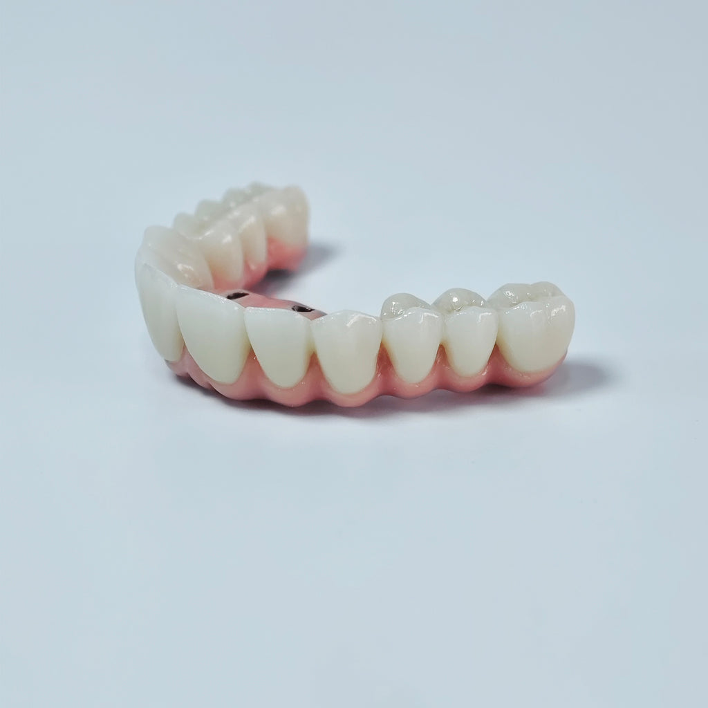 Zirconia-Enamel Hybrid Malo Bridge