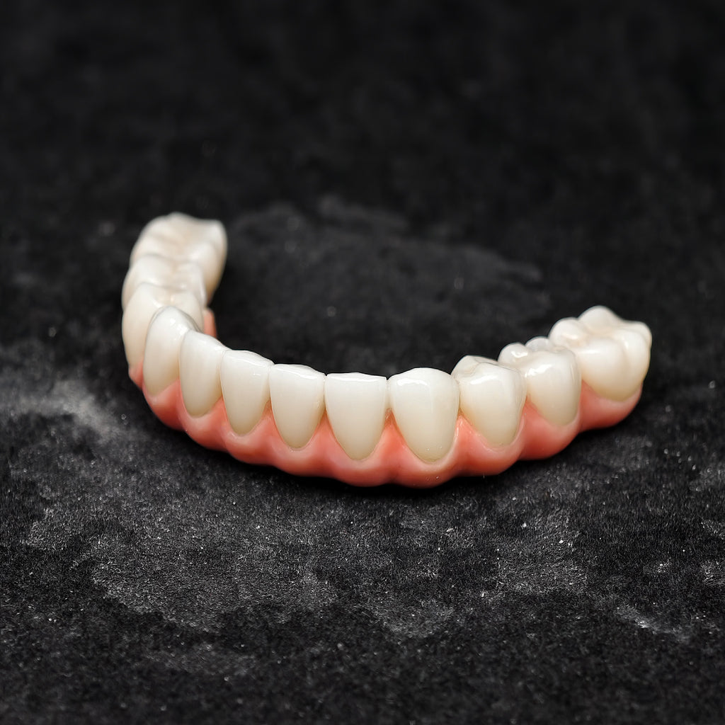 Zirconia-Enamel Hybrid Malo Bridge