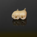 Zirconia Bridge With Screw Retained