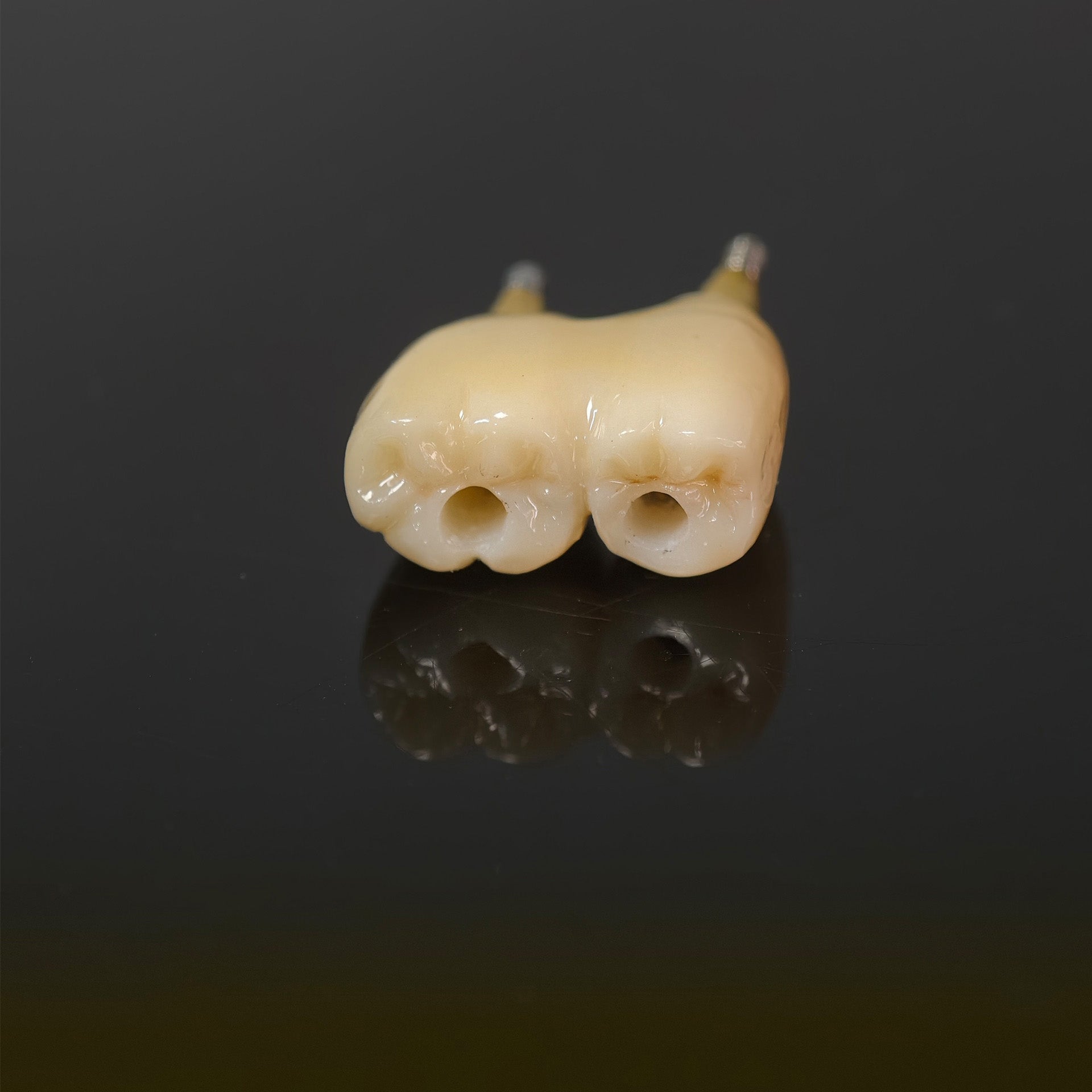 Zirconia Bridge With Screw Retained