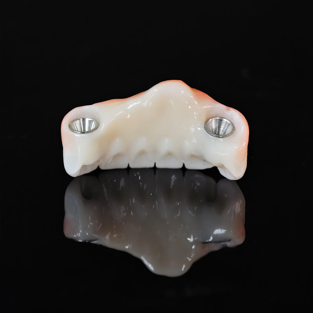 Zirconia Bridge With Ti-Base Screw Retained