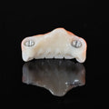 Zirconia Bridge With Ti-Base Screw Retained