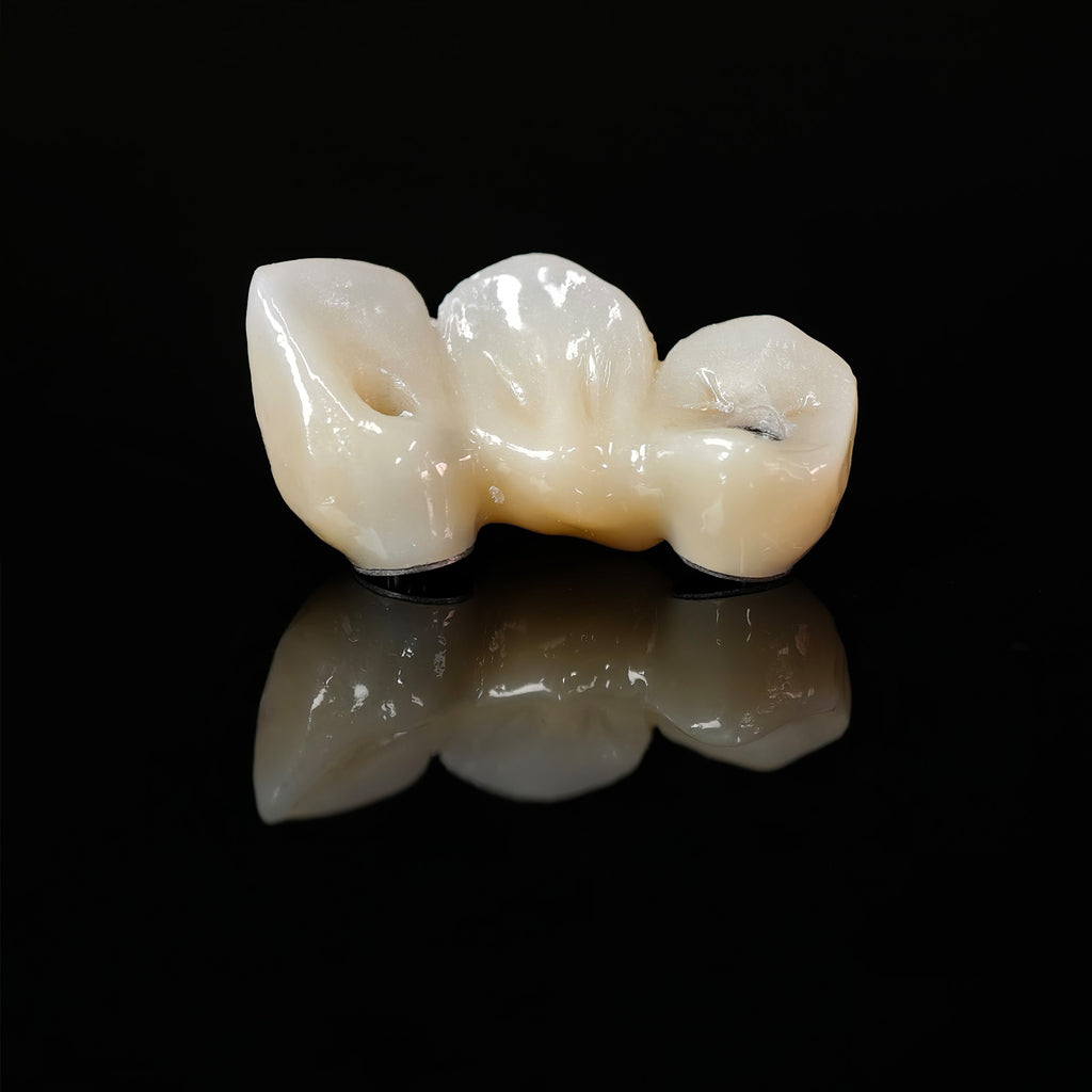 Zirconia Bridge With Ti-Base Screw Retained