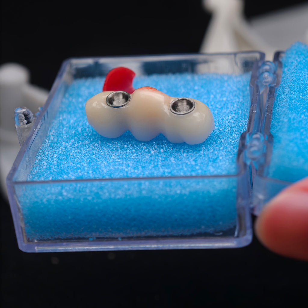 Zirconia Bridge With Ti-Base Screw Retained