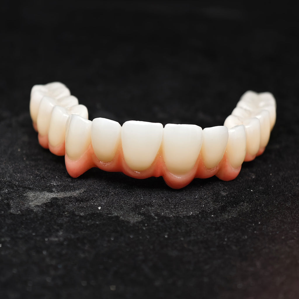 Zirconia Bridge With Cement Retained