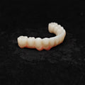 Zirconia Bridge With Cement Retained