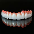 Zirconia Bridge With Cement Retained And Titanium Bar