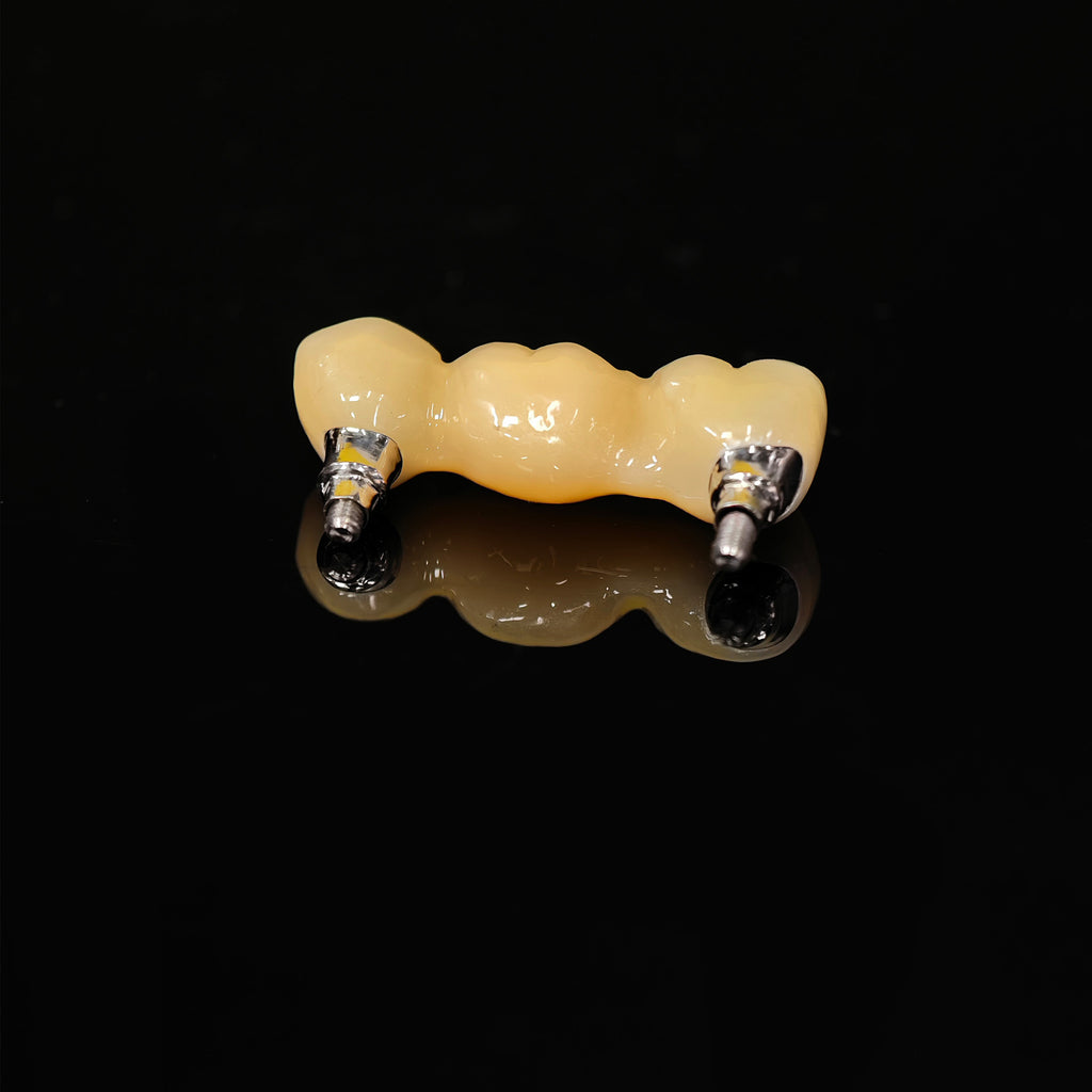 Zirconia Bridge With Screw Retained