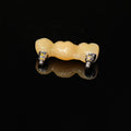 Zirconia Bridge With Screw Retained