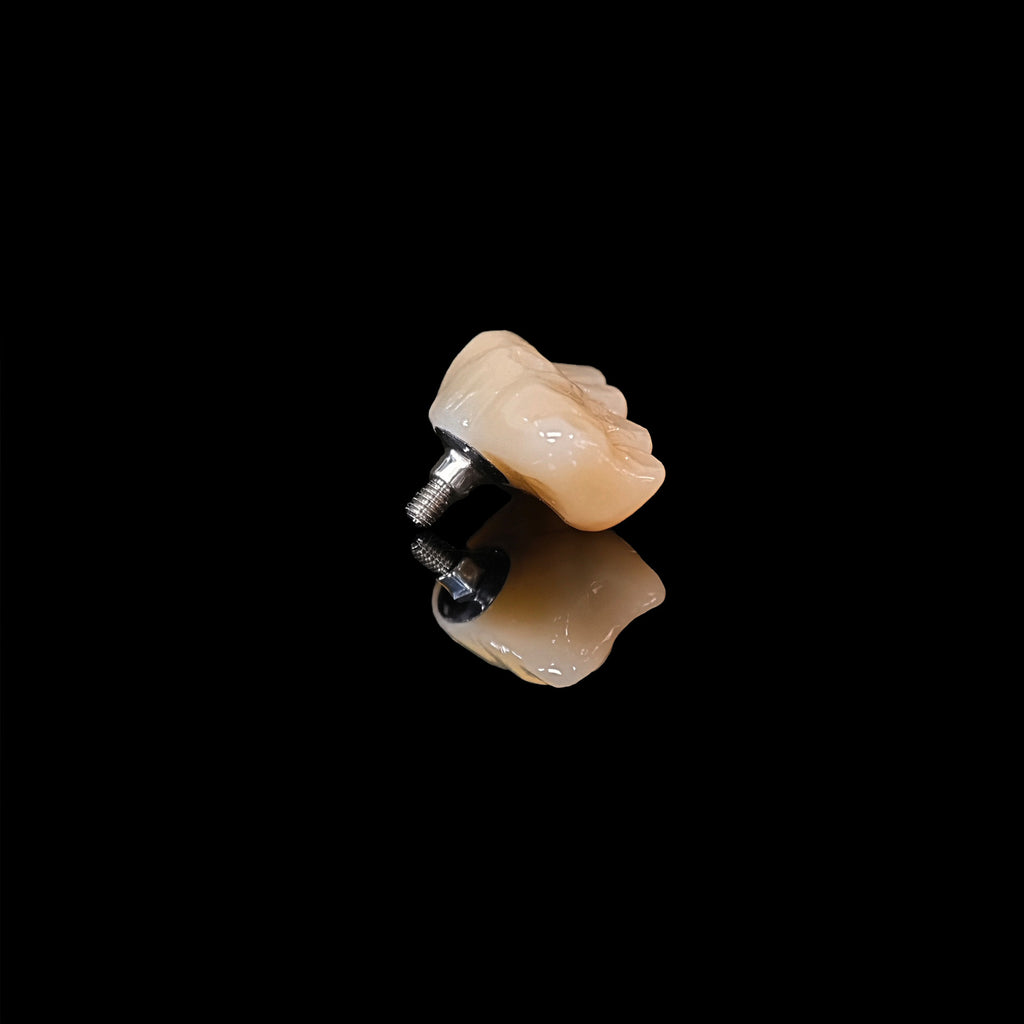 Zirconia Bridge With Screw Retained