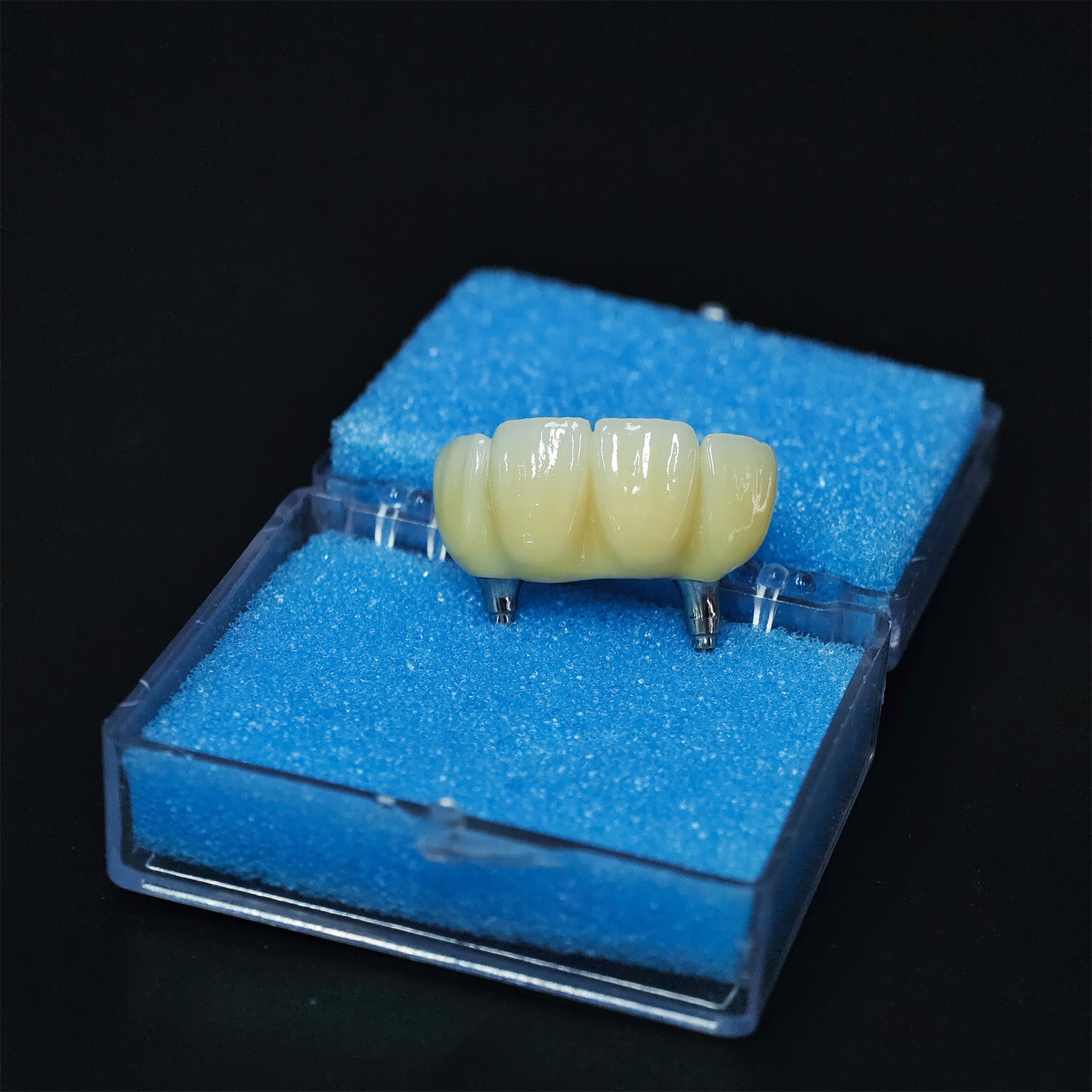 Zirconia Bridge With Screw Retained