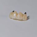 Zirconia Bridge With Screw Retained