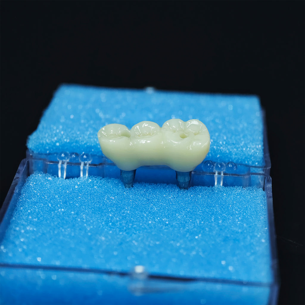 Zirconia Bridge With Screw Retained