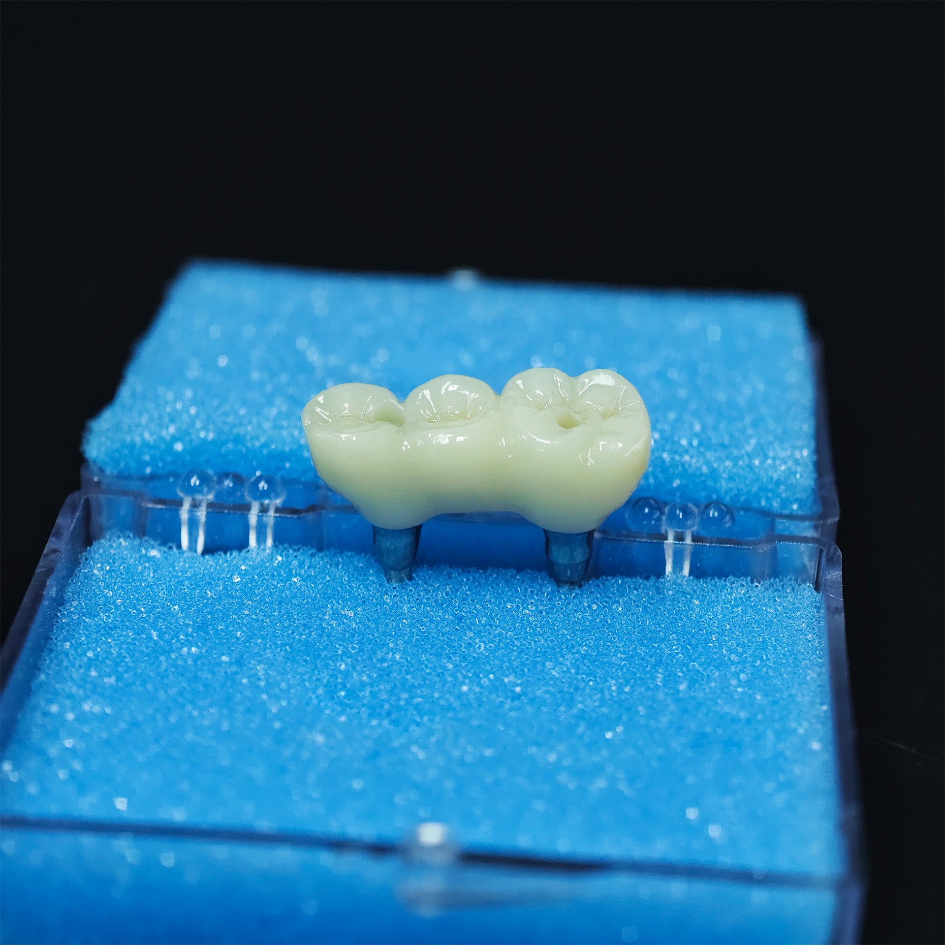 Zirconia Bridge With Screw Retained